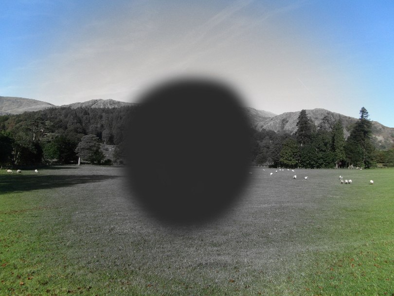 central vision loss photo